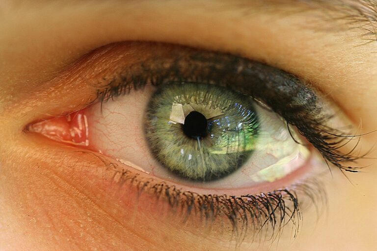 eye-714503_1280